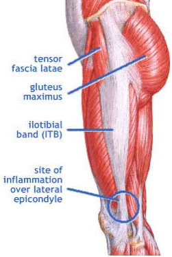 The Glutes and the ITB - Regenexx