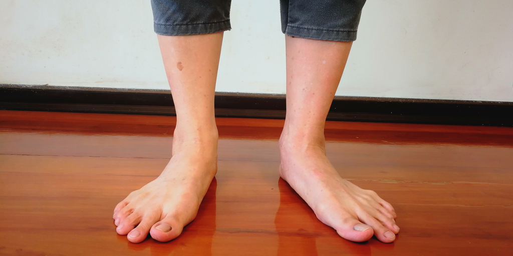 Pronation and supination while walking